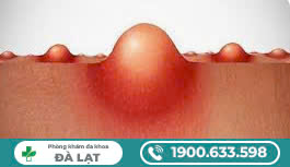 Hình ảnh minh họa